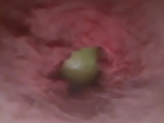 Ups I just dumped apple:)